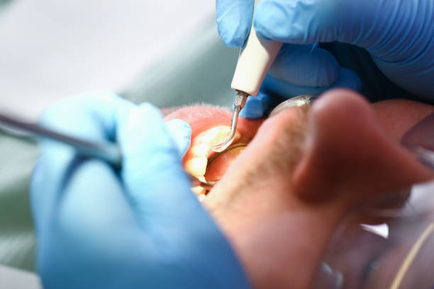 Best Broken or Chipped Tooth Repair in Mechanicsburg, OH